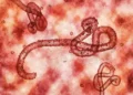 UAE Activates High-Level Health Surveillance to Monitor Ebola Developments